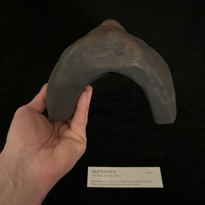A top-down grip displays the structural thickness and internal curvature of the cast.